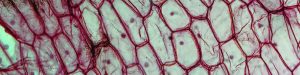 Light photomicrograph of an Onion epidermus seen through a microscope
