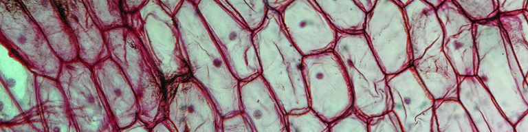 Light photomicrograph of an Onion epidermus seen through a microscope